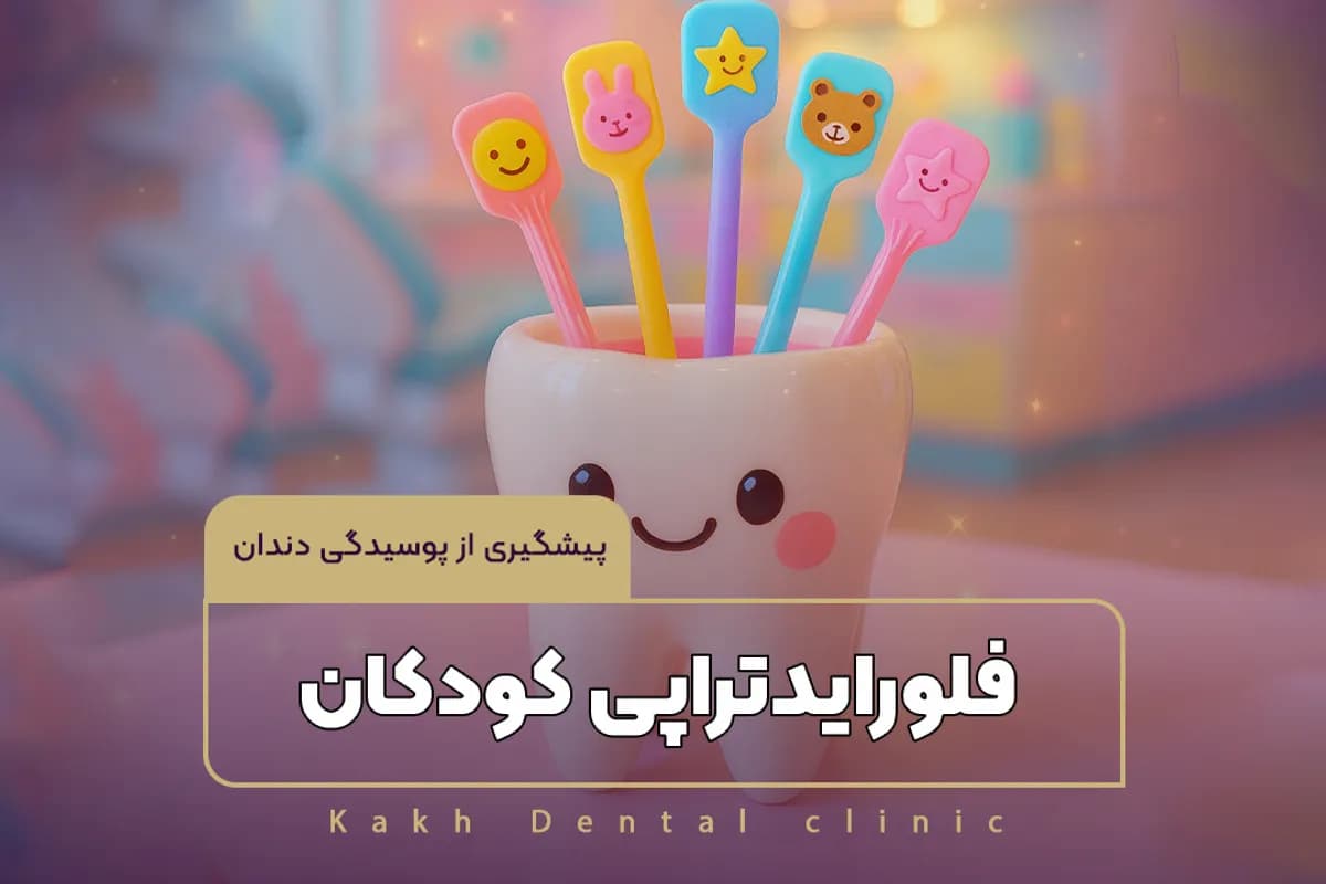 https://s2.webstatic.net/post/fluoride-therapy-children-tooth-decay-prevention/17605258056606b6-1200x800.webp